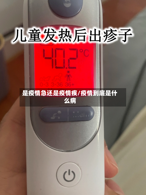 是疫情急还是疫情疾/疫情到底是什么病