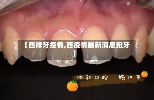 【西排牙疫情,西疫情最新消息班牙】