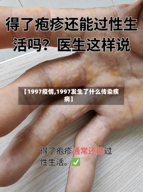 【1997疫情,1997发生了什么传染疾病】